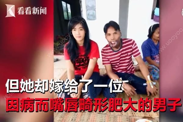 美女離婚改嫁畸形嘴丑男，前夫指責“她一定是為了錢”(2)