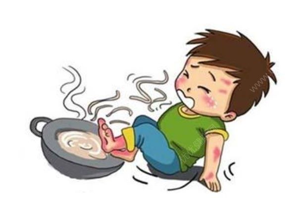 4歲男孩一屁股坐進(jìn)開(kāi)水桶，全身65%燙傷，燙傷急救處理方法(1)