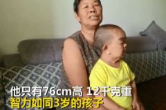 48歲兒子僅76厘米3歲智商永遠(yuǎn)"長(zhǎng)不大" 71歲母親不敢撒手[多圖]