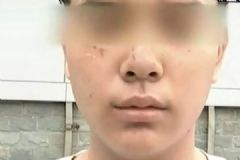 打籃球13歲少年被抓成花臉，如何解決廣場舞擾民問題[多圖]