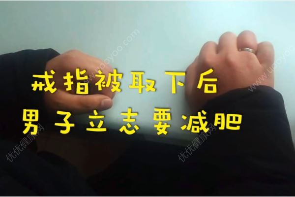 男子春節(jié)吃的太胖，戒指卡手上取不下來(4)