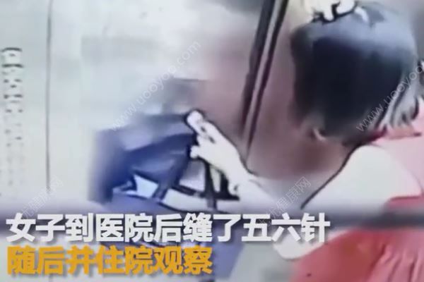 電梯吊頂突然墜落，女子慘被砸破頭，乘坐電梯注意事項(3)