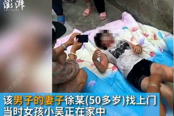 17歲少女在家被人用開水灌喉，嫌犯疑為母親