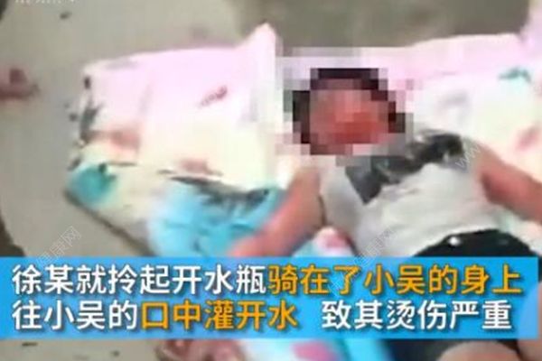 17歲少女在家被人用開水灌喉，嫌犯疑為母親