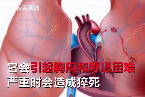 男子打麻將久坐不起險猝死，打麻將猝死是什么原因？(3)