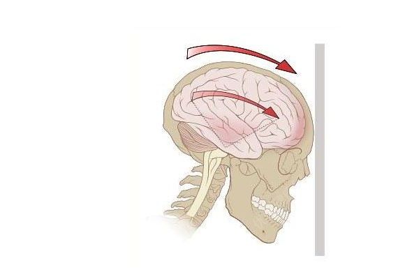 男子樓梯墜下昏迷，8個月大兒子哭鬧將其喚醒(4)