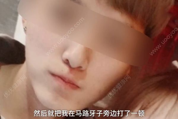 小伙沒給陌生人微信被追打！女友說因為他長得帥呀！(2)