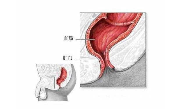 冬天拉屎大便出血怎么回事？冬天便血飲食調(diào)理方法(2)