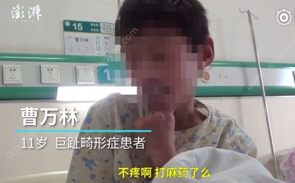 媒體傳11歲大腳娃手術為省錢不打二百元麻藥，被批真外行(3)