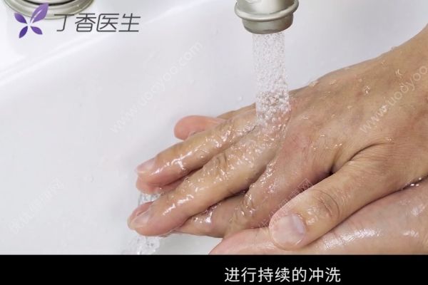 為治感冒給孩子蒸足燙傷，燙傷如何緊急處理？(2)