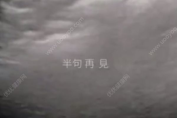 孫燕姿曬二胎寶寶B超視頻做新歌預(yù)告，懷二胎要注意什么？(3)