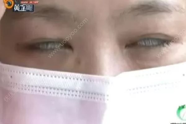 女子美容院出來眼睛合不上，睡覺要用膠帶粘眼皮(3)