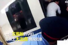 三胞胎孕婦火車上大出血，孕婦大出血該怎么辦？[多圖]