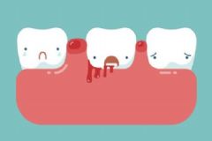 牙齦出血的原因有什么？牙齦出血怎么調理？[圖]