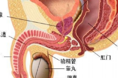 前列腺炎鈣化是什么？前列腺炎鈣化能治好嗎？[圖]