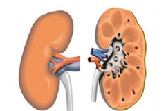 腎炎該怎么治療最好？腎炎有傳染性嗎？[圖]