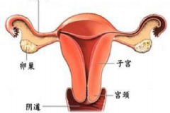 附件炎如何根治？附件炎是怎么引起的？[圖]