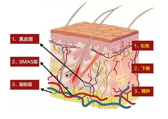 什么是赫本線？聯(lián)合麗格向淑英抗衰新理念：45°赫本線緊致術(shù)