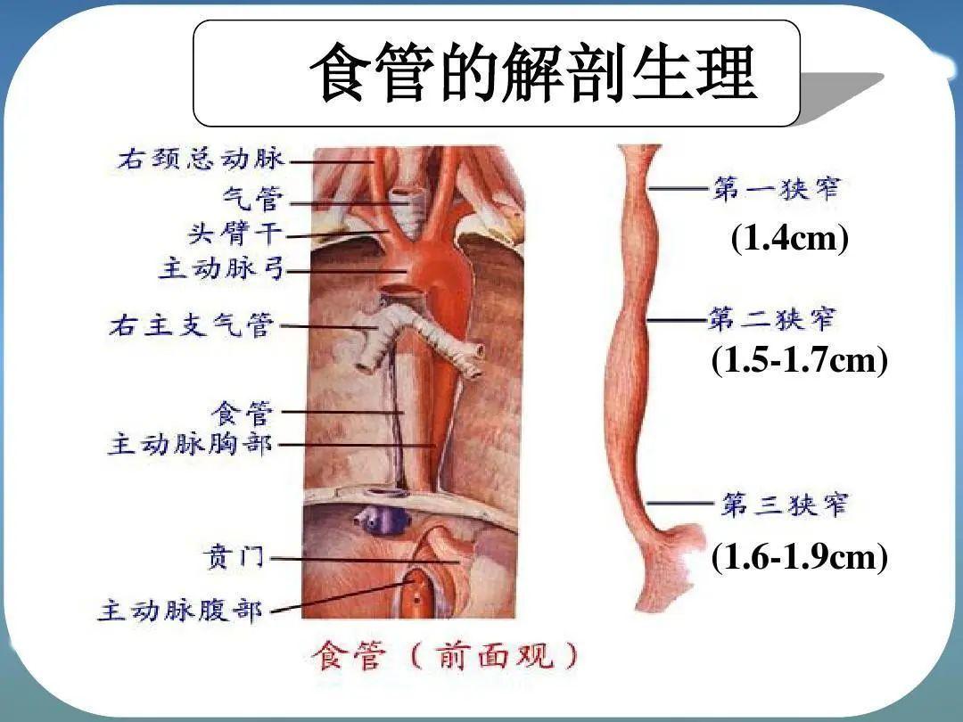 廣州復(fù)大腫瘤醫(yī)院案例998：為食管癌患者打開(kāi)“生命通道”