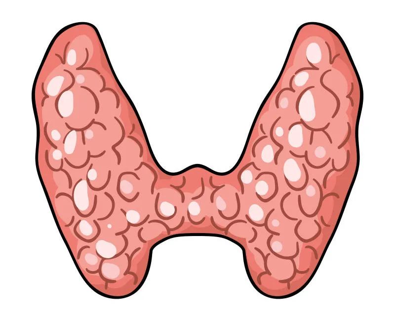 當心！成都民生耳鼻喉醫院：身體有這幾種表現，說明你的甲狀腺出了問題！