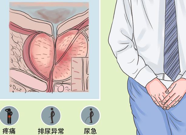 哪些因素會引起前列腺增生 久坐缺少激素性生活過度放縱