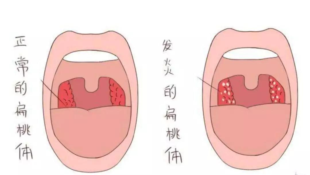 成都民生耳鼻喉醫院一大波優惠活動來襲！耳鼻喉內窺鏡檢查免費，預約從速！