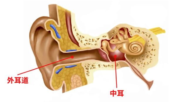 中耳炎和外耳道炎的區別？中耳炎和腮腺炎的區別？