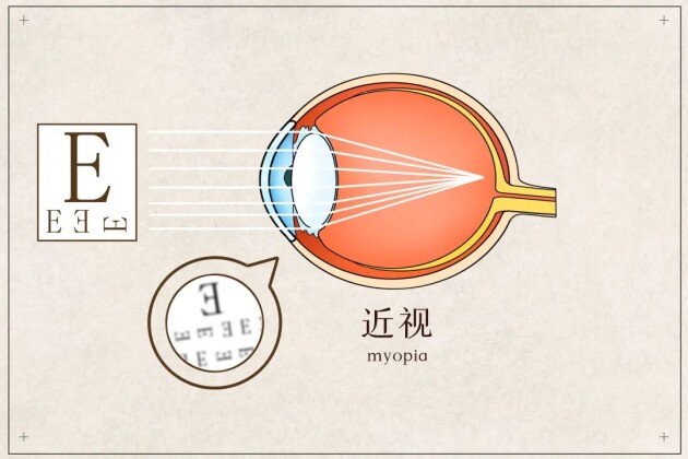 【直播預(yù)告】開學(xué)第一課，名醫(yī)名師教你近視管理和專注力提升，以最佳狀態(tài)為新學(xué)期開篇！