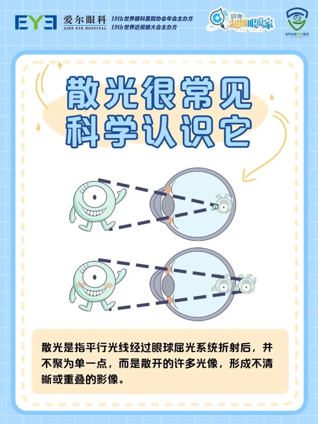 合肥愛爾眼科：孩子散光多少度，需要配眼鏡？