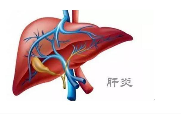 A型肝炎是什么病？A型肝炎常見知識？