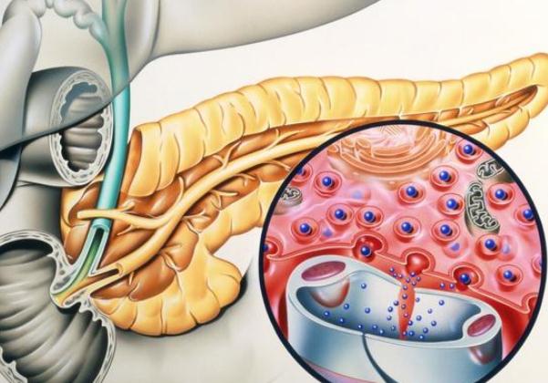 胰腺癌到底有多可怕？ 哪些人容易得胰腺癌？