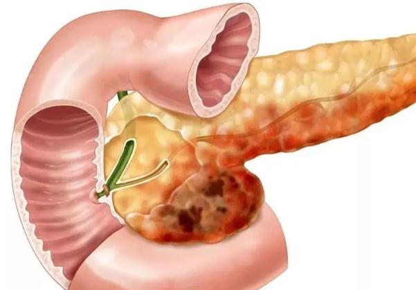 胰腺炎為什么不能喝水？狗狗胰腺炎能治好嗎？