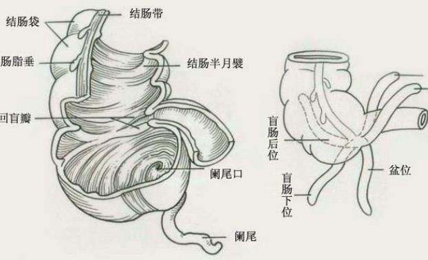 闌尾炎是什么原因造成的 闌尾炎注意什么