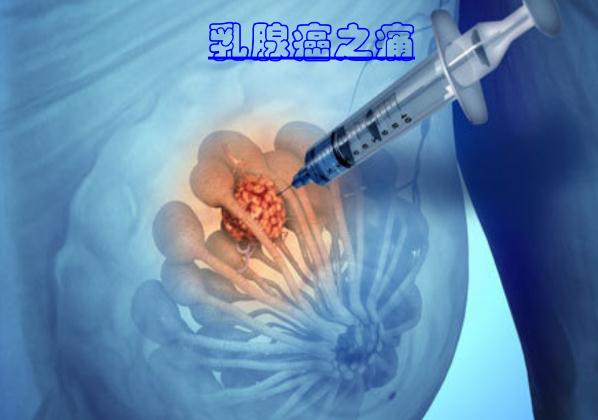 這些食物可以預(yù)防乳腺癌 ？乳腺癌手術(shù)后多久化療？