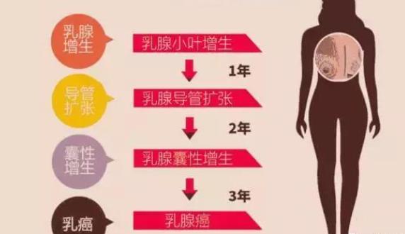 乳腺增生反復發作還疼怎么回事 乳腺增生轉癌會怎么樣