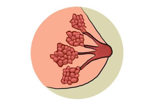 乳腺結節可以治好嗎 將切除腫塊組織病理檢查根治